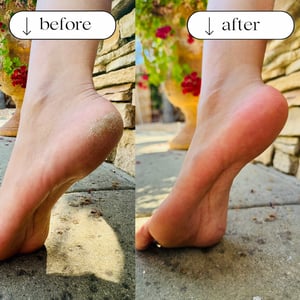 💥Foot File Exfoliates and softens callused and cracked feet. Say hello to baby soft feet!